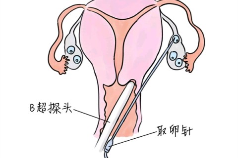 http://jinan.vdtfzz.com/post/205.html|济南供卵助孕